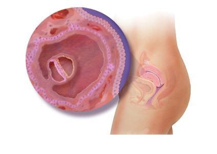 ���е�3��